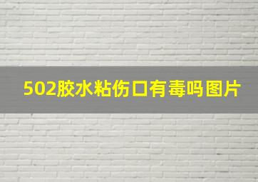 502胶水粘伤口有毒吗图片