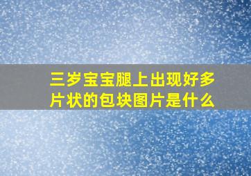 三岁宝宝腿上出现好多片状的包块图片是什么