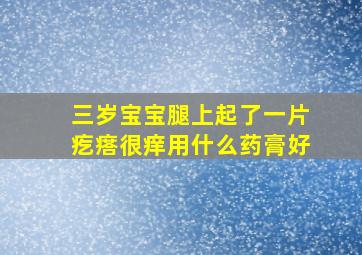 三岁宝宝腿上起了一片疙瘩很痒用什么药膏好