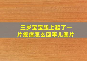 三岁宝宝腿上起了一片疙瘩怎么回事儿图片