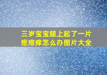 三岁宝宝腿上起了一片疙瘩痒怎么办图片大全