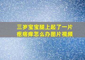 三岁宝宝腿上起了一片疙瘩痒怎么办图片视频