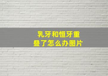 乳牙和恒牙重叠了怎么办图片