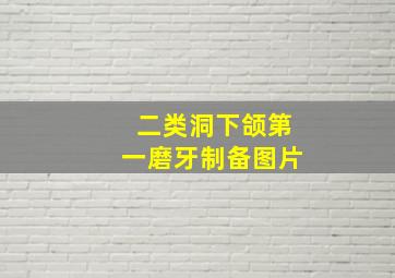 二类洞下颌第一磨牙制备图片