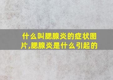 什么叫腮腺炎的症状图片,腮腺炎是什么引起的