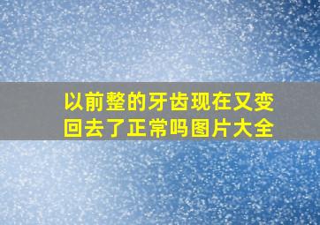 以前整的牙齿现在又变回去了正常吗图片大全