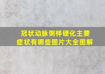 冠状动脉粥样硬化主要症状有哪些图片大全图解