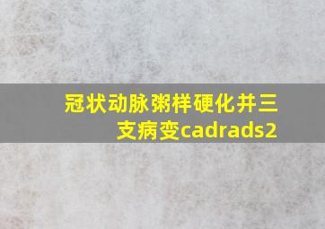 冠状动脉粥样硬化并三支病变cadrads2