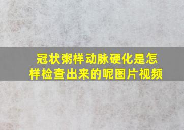 冠状粥样动脉硬化是怎样检查出来的呢图片视频