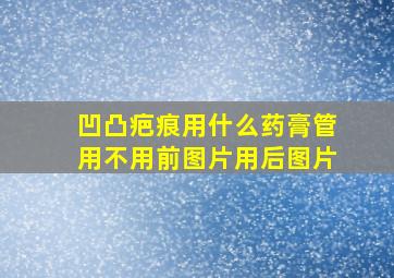 凹凸疤痕用什么药膏管用不用前图片用后图片