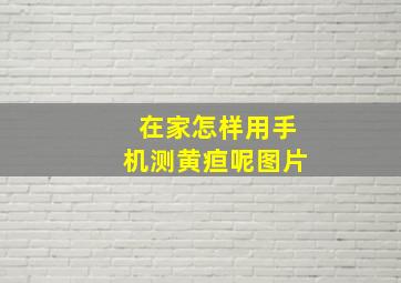 在家怎样用手机测黄疸呢图片