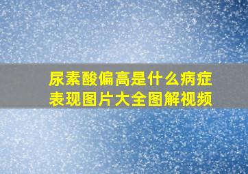 尿素酸偏高是什么病症表现图片大全图解视频