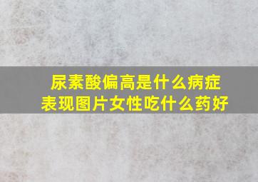 尿素酸偏高是什么病症表现图片女性吃什么药好