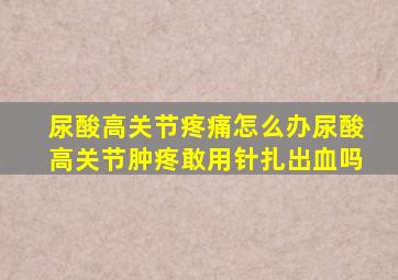 尿酸高关节疼痛怎么办尿酸高关节肿疼敢用针扎出血吗