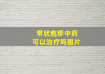 带状疱疹中药可以治疗吗图片