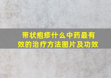 带状疱疹什么中药最有效的治疗方法图片及功效