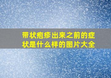 带状疱疹出来之前的症状是什么样的图片大全