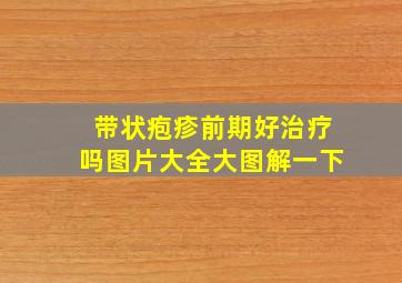 带状疱疹前期好治疗吗图片大全大图解一下