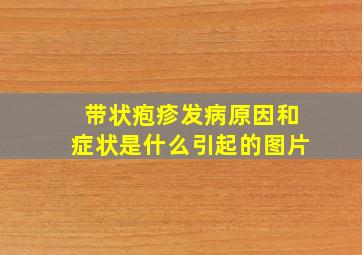 带状疱疹发病原因和症状是什么引起的图片