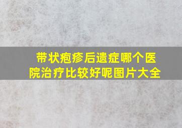 带状疱疹后遗症哪个医院治疗比较好呢图片大全