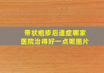 带状疱疹后遗症哪家医院治得好一点呢图片