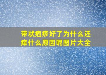 带状疱疹好了为什么还痒什么原因呢图片大全