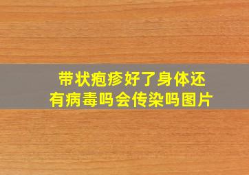 带状疱疹好了身体还有病毒吗会传染吗图片