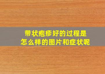 带状疱疹好的过程是怎么样的图片和症状呢