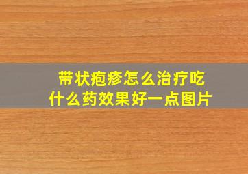 带状疱疹怎么治疗吃什么药效果好一点图片