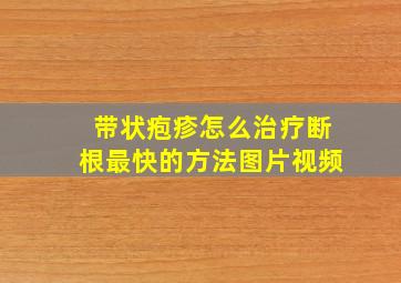 带状疱疹怎么治疗断根最快的方法图片视频