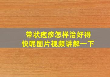 带状疱疹怎样治好得快呢图片视频讲解一下