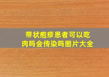 带状疱疹患者可以吃肉吗会传染吗图片大全