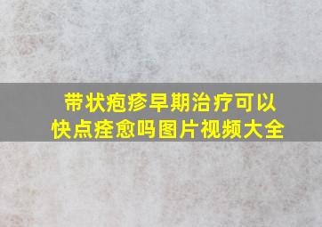 带状疱疹早期治疗可以快点痊愈吗图片视频大全