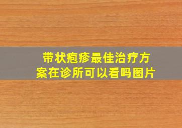 带状疱疹最佳治疗方案在诊所可以看吗图片