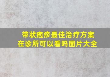 带状疱疹最佳治疗方案在诊所可以看吗图片大全