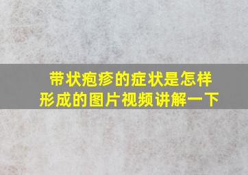 带状疱疹的症状是怎样形成的图片视频讲解一下