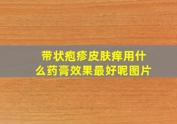 带状疱疹皮肤痒用什么药膏效果最好呢图片