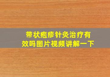 带状疱疹针灸治疗有效吗图片视频讲解一下