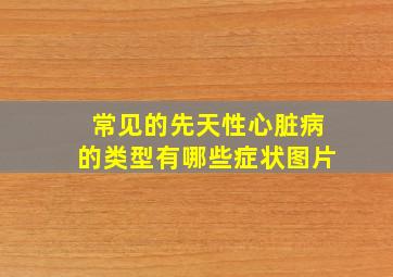 常见的先天性心脏病的类型有哪些症状图片