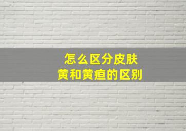 怎么区分皮肤黄和黄疸的区别