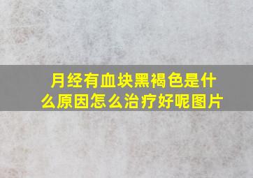 月经有血块黑褐色是什么原因怎么治疗好呢图片