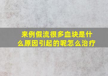 来例假流很多血块是什么原因引起的呢怎么治疗