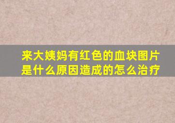 来大姨妈有红色的血块图片是什么原因造成的怎么治疗