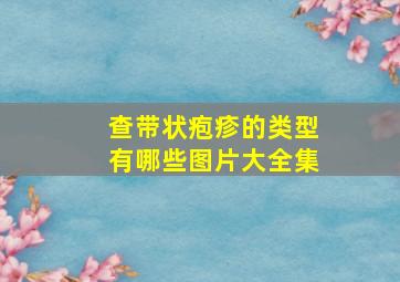 查带状疱疹的类型有哪些图片大全集