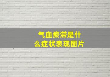 气血瘀滞是什么症状表现图片