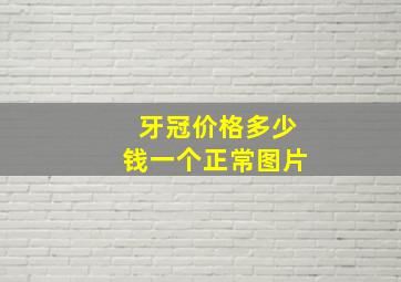 牙冠价格多少钱一个正常图片