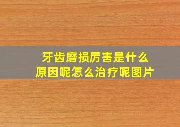 牙齿磨损厉害是什么原因呢怎么治疗呢图片