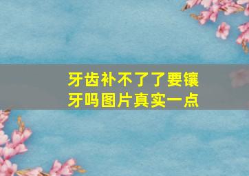 牙齿补不了了要镶牙吗图片真实一点