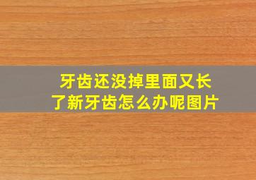 牙齿还没掉里面又长了新牙齿怎么办呢图片