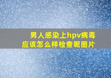 男人感染上hpv病毒应该怎么样检查呢图片